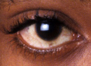 tupac eyes